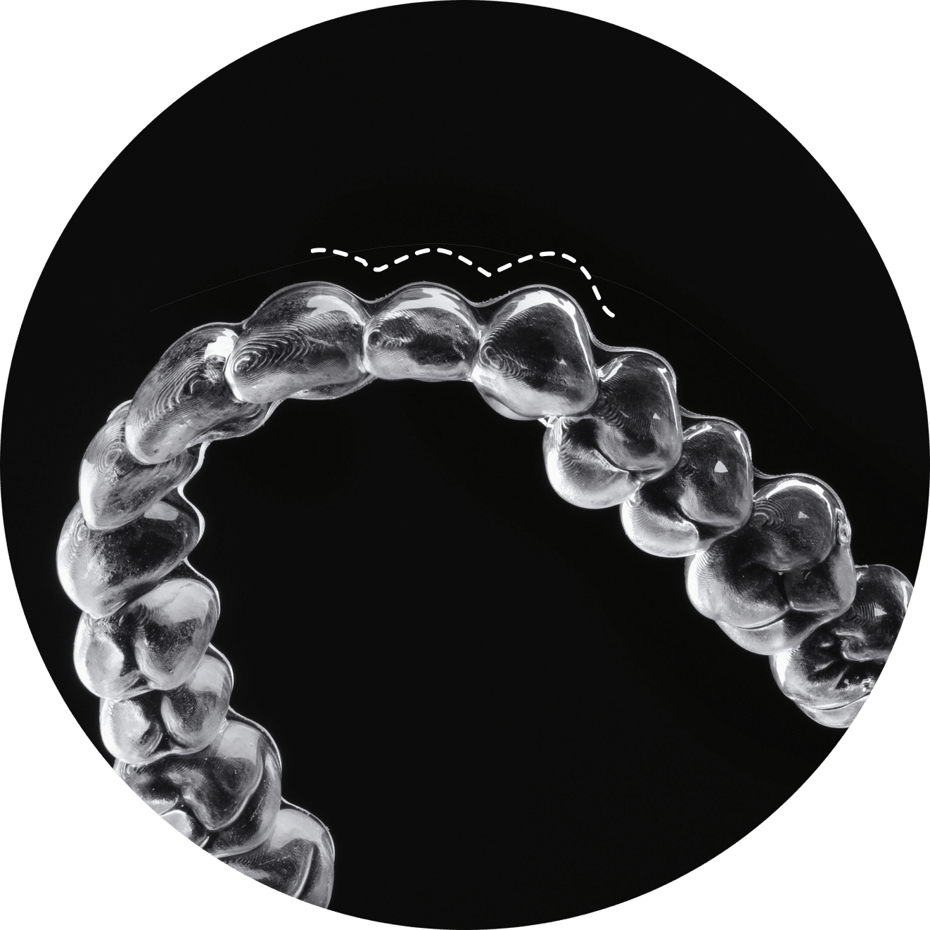 aligner-trim - orthoclear